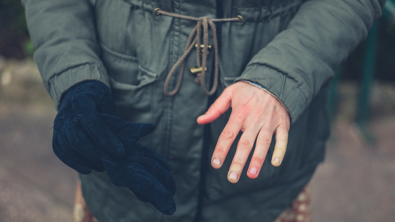person outdoors with Raynaud's hand