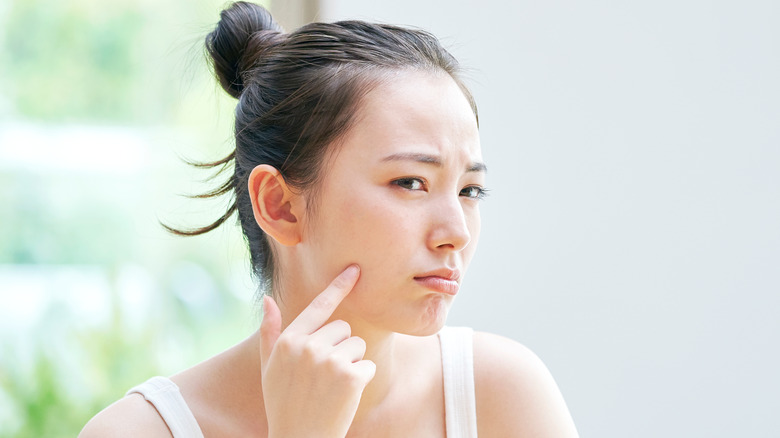 A woman pointing at her troubled skin 