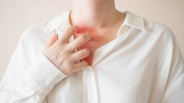 Woman suffering from an itchy chest 
