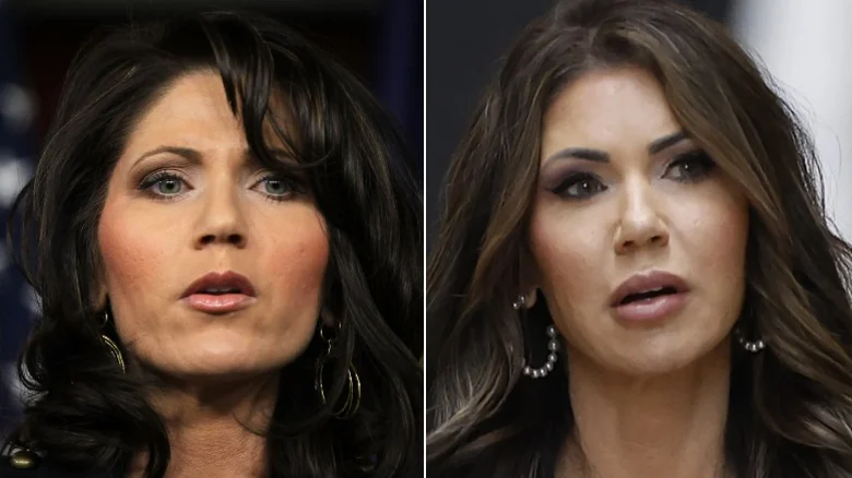 kristi-noem-updated-her-face-to-land-a-position-in-the-trump-administration-1742738665.webp