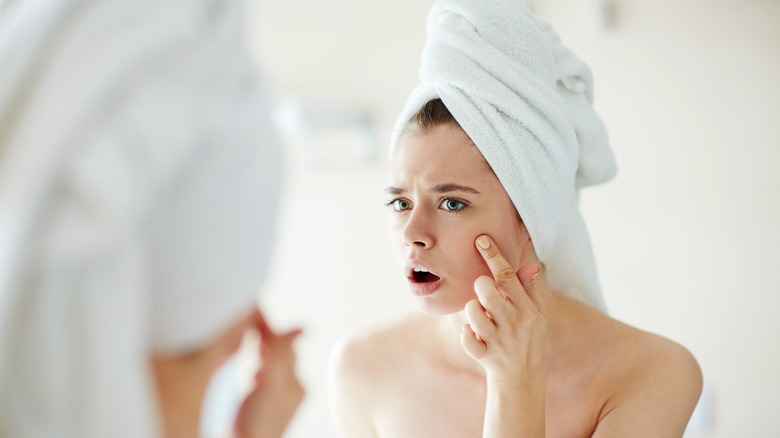 Woman with acne
