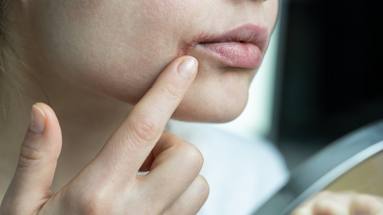woman examining her lip eczema