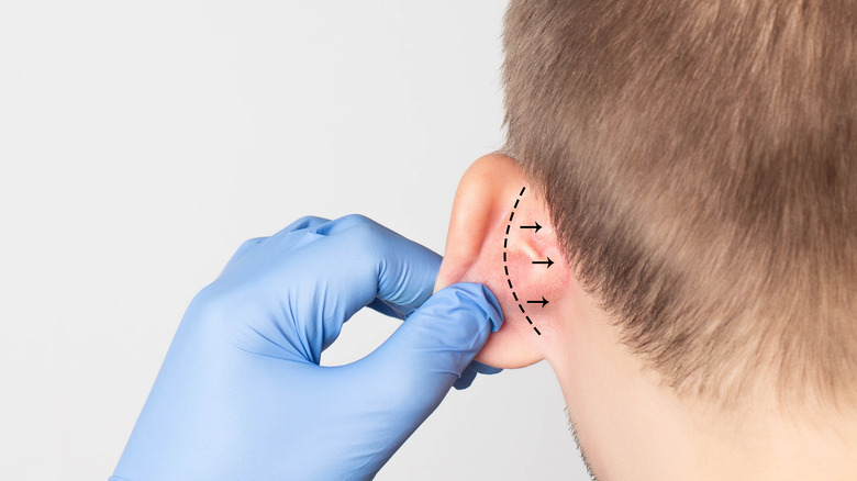 Doctor examines person's ear for procedure