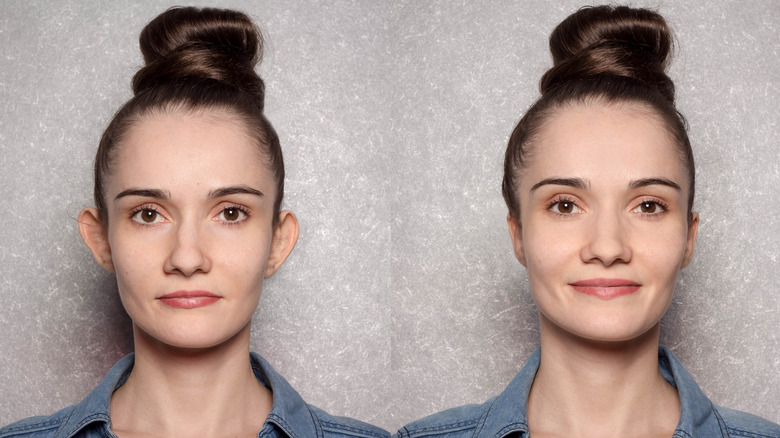 Woman's appearance before and after otoplasty