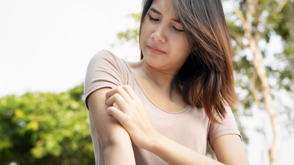 A woman scratching her arm