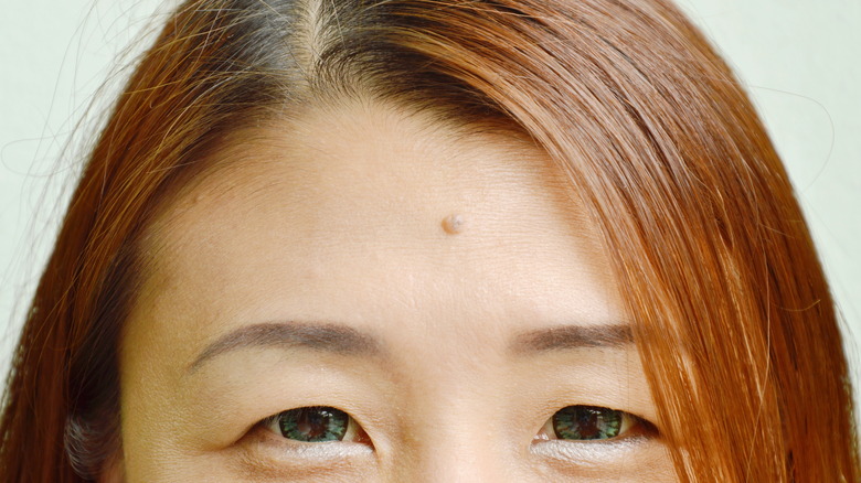 Woman with mole on forehead 