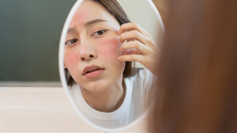 woman examining red cheek in mirror