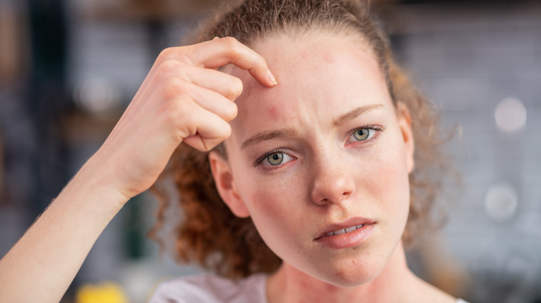 Woman itching forehead 