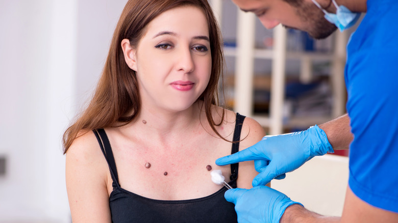 Woman getting chest moles examined