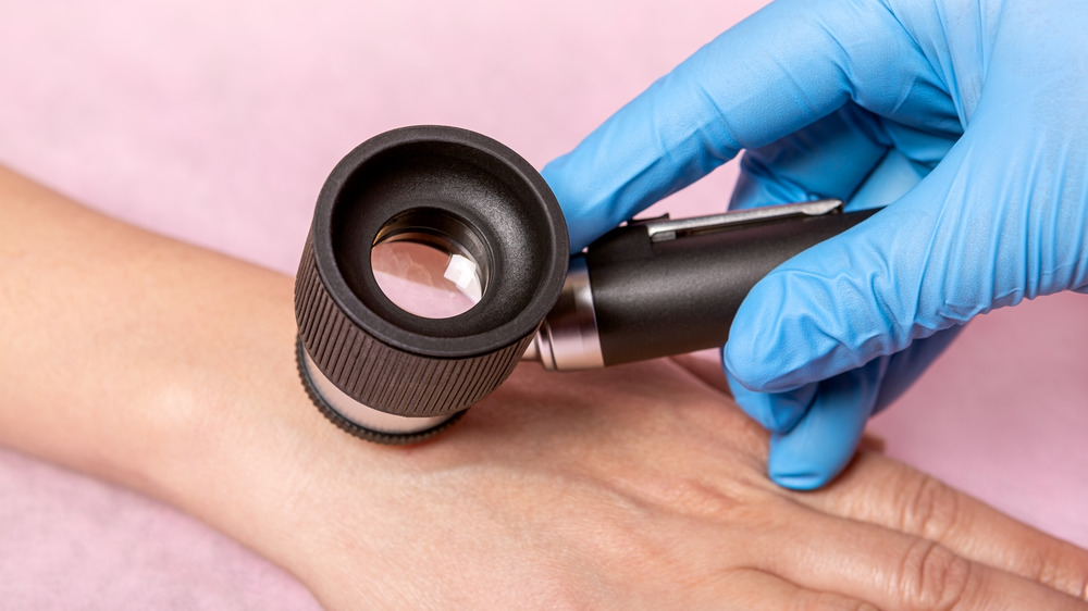 doctor checking mole on a woman's hand