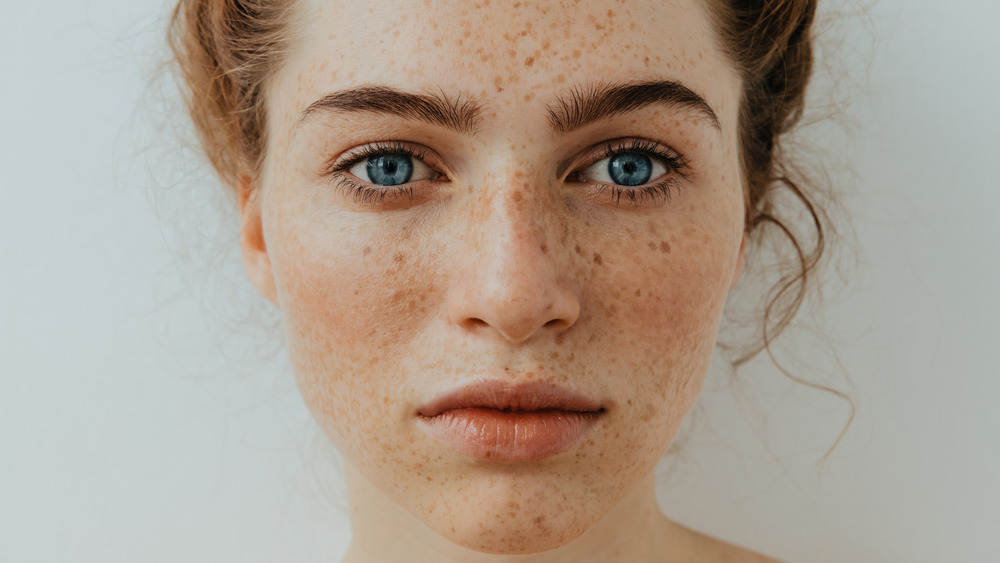 Women with freckles on face