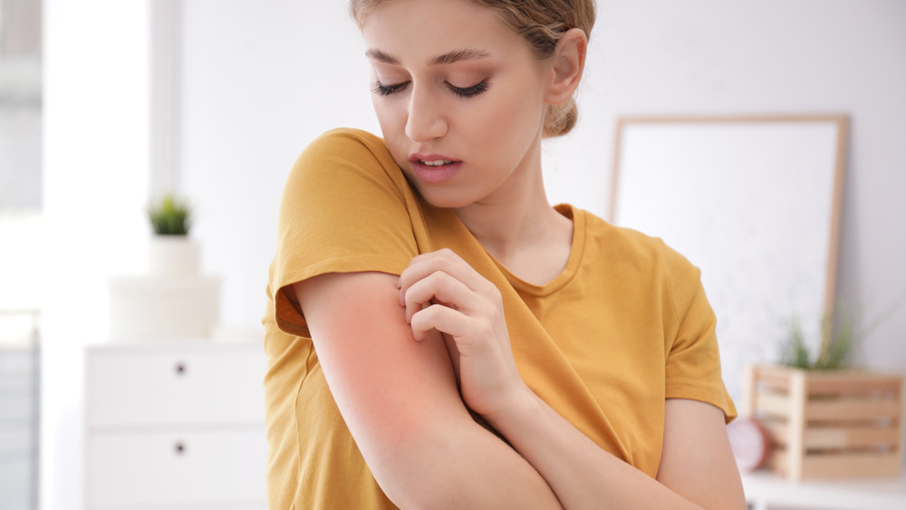 Woman scratching her arm