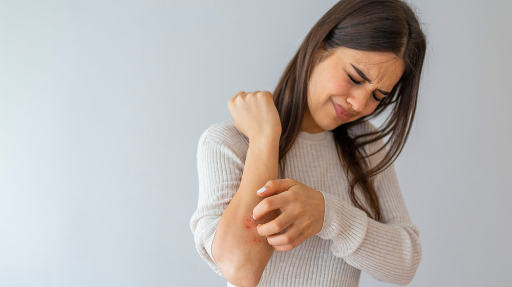 Wman scratches her forearm 