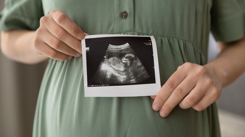 Pregnant person holding ultrasound picture