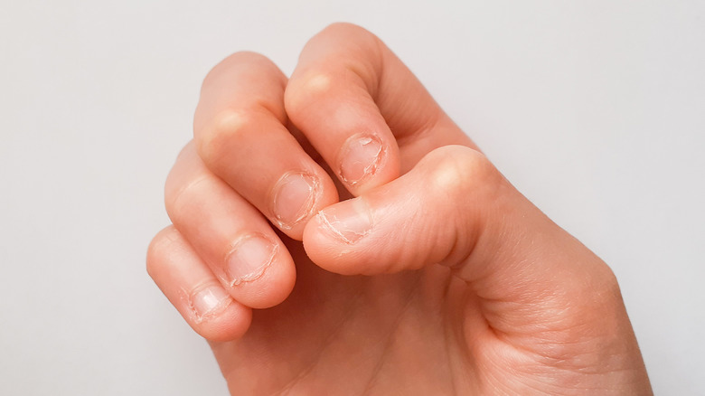 Beautiful Sculpted Acrylics for Bitten Nails