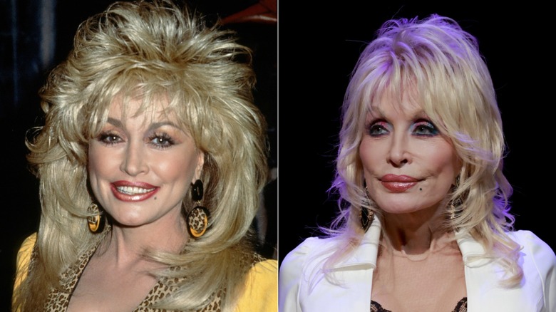Dolly Parton circa 1990 & on stage at an event in 2025