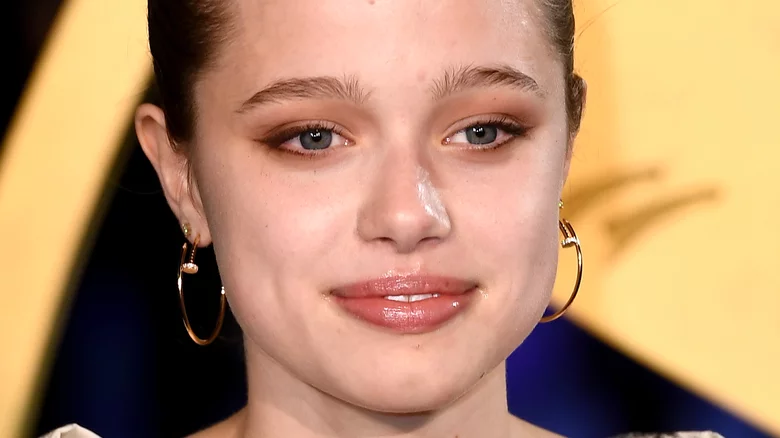 Photos Of Their Transformations In 2025 Are Stunning - cover