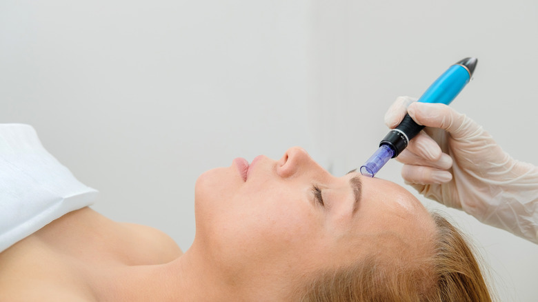 Microneedling