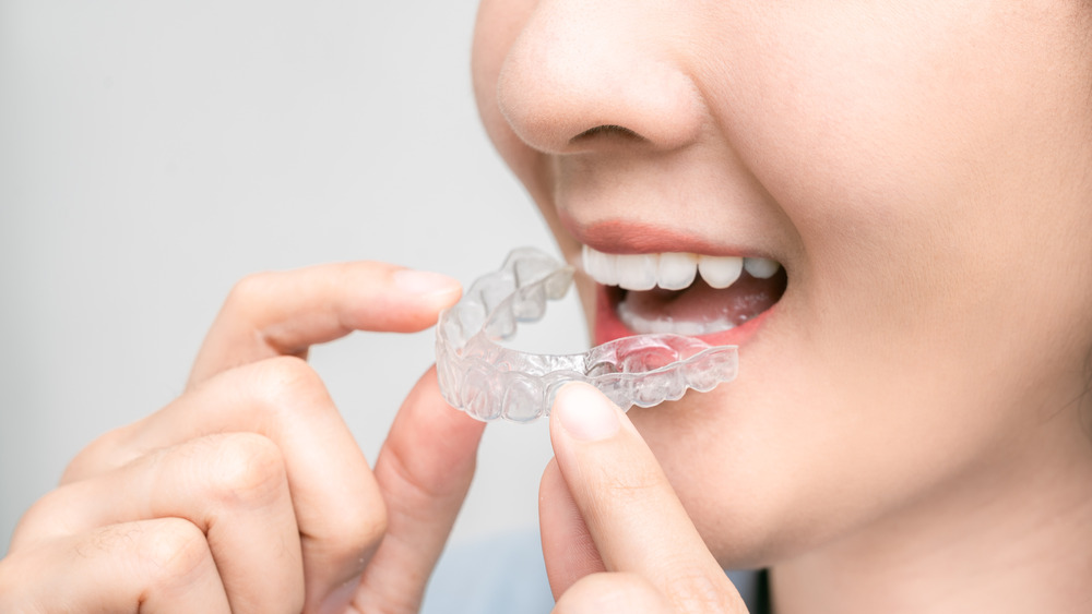 Close-up of woman holding retainer