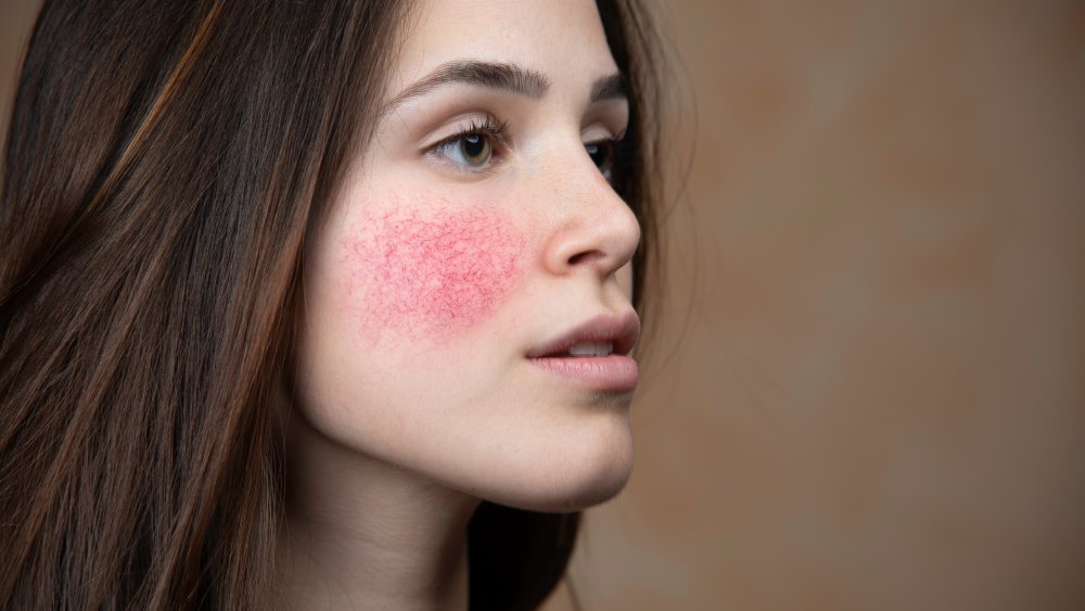 allergic reaction from makeup