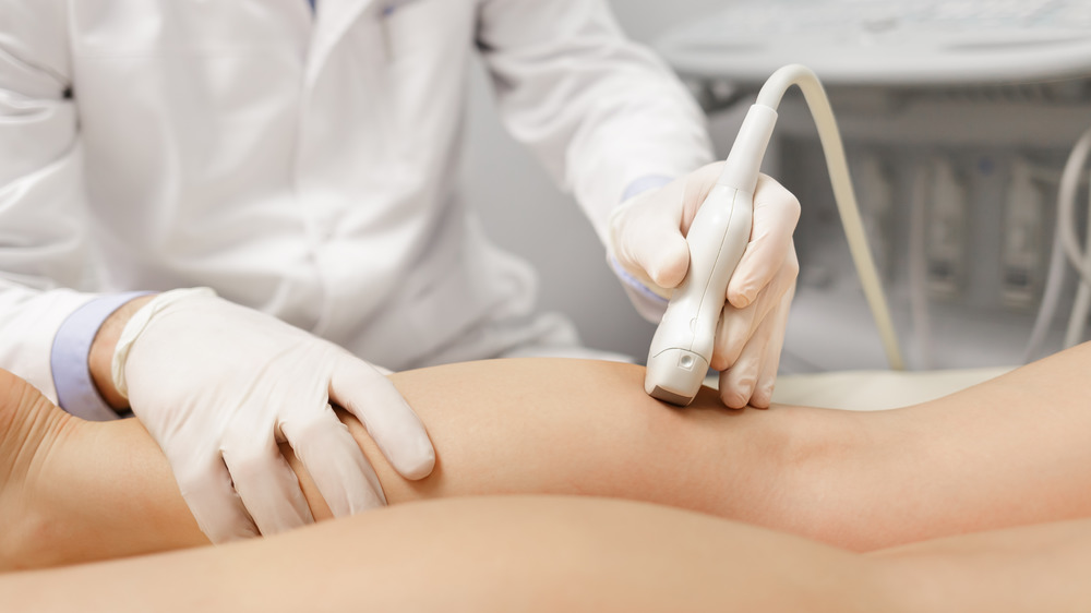 Doctor using ultrasound equipment to examine leg veins prior to treatment