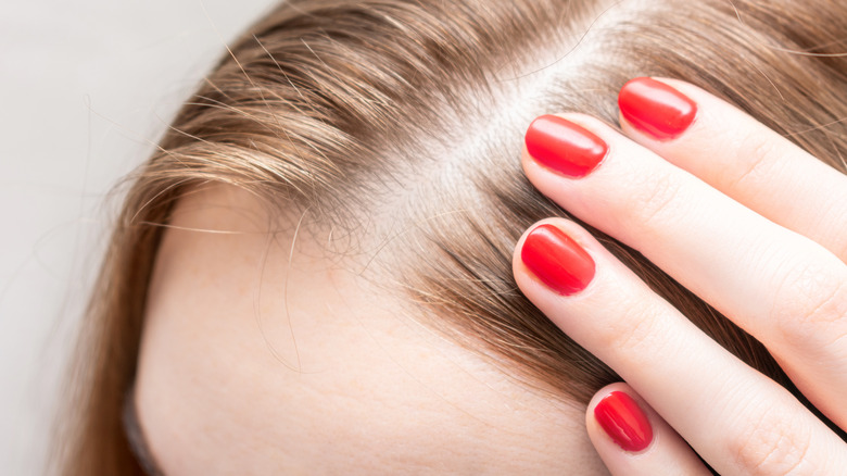 Woman with thinning hairline