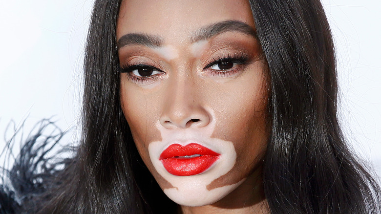 Winnie Harlow poses at a red carpet