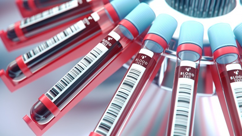 A centrifuge of blood tests
