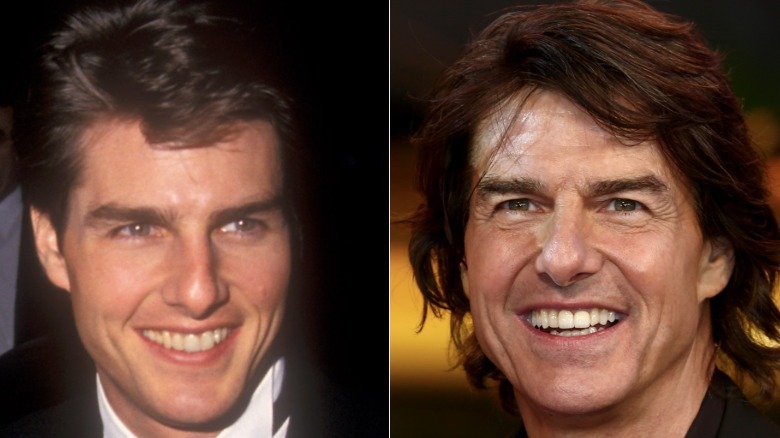 Composite side by side photos of Tom Cruise showing his purported plastic surgery