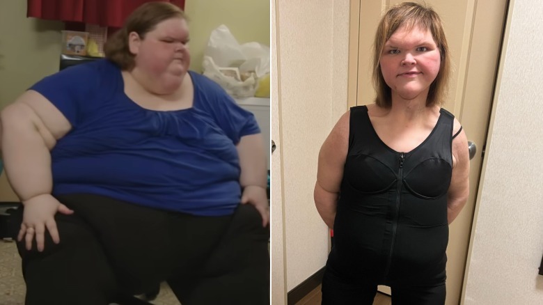 Tammy Slaton before and after major weight loss