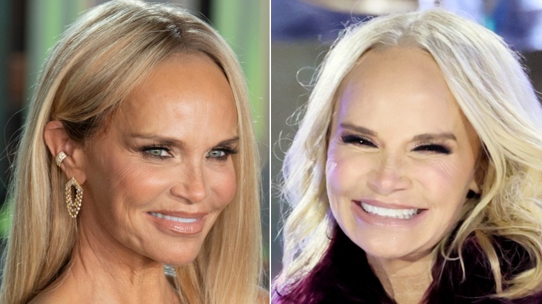 Left image shows Kristin Chenoweth smiling at an event and the right image shows Chenoweth smiling during a presentation in Rockefeller Center