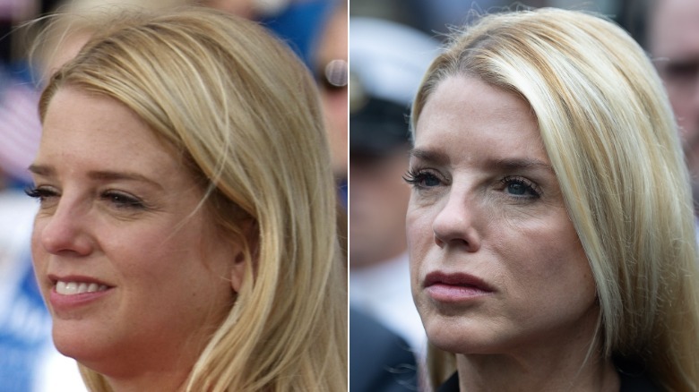Pam Bondi before and after