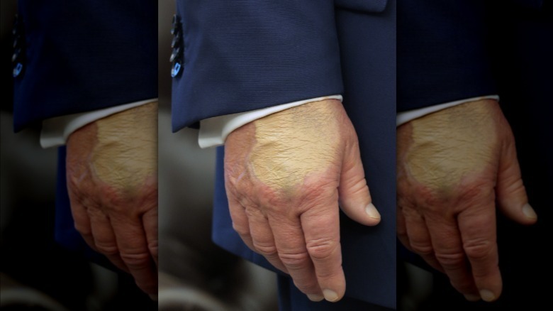 Close up photo of make up smeared on Donald Trump's right hand (2025)