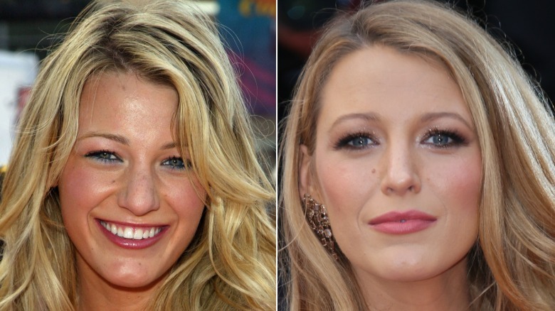 Blake Lively on the left in 2005 at the Kids Choice Awards and Blake Lively on the right in 2016 with a very different nose