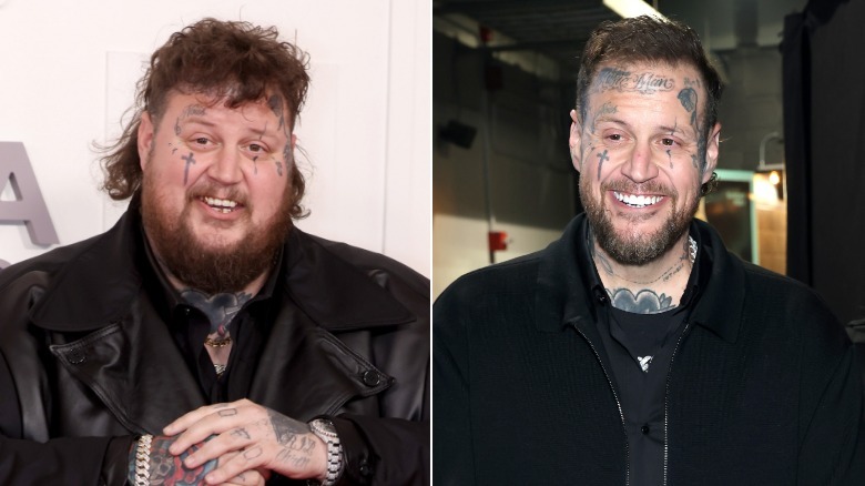 Two pictures of the Country singer Jelly Roll. One when he weighed around 500 pounds. The other after he lost almost 300 pounds.