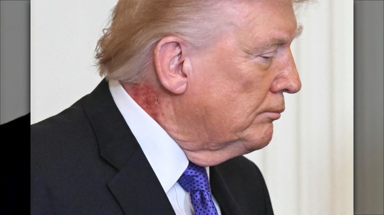 Donald Trump frowning