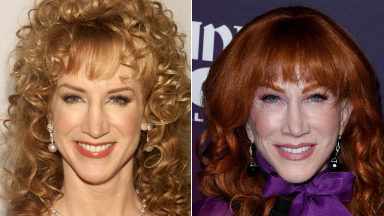 Kathy Griffin before and after