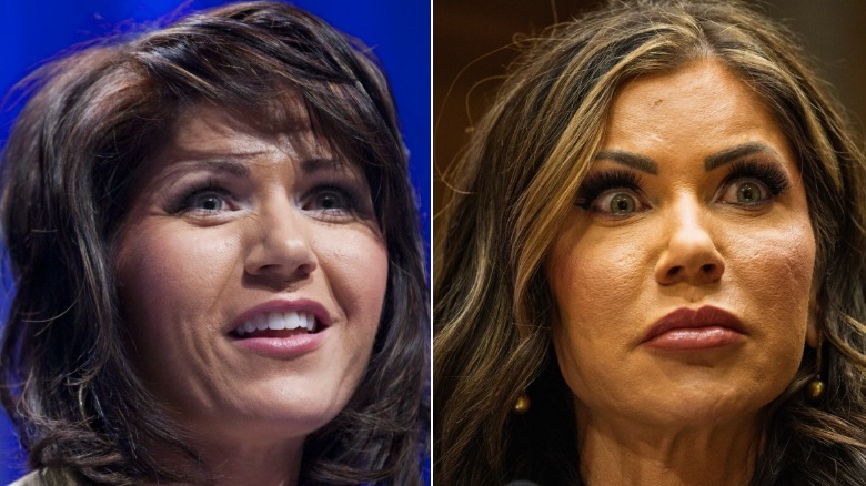 Kristi Noem before plastic surgery on the left and after on the right