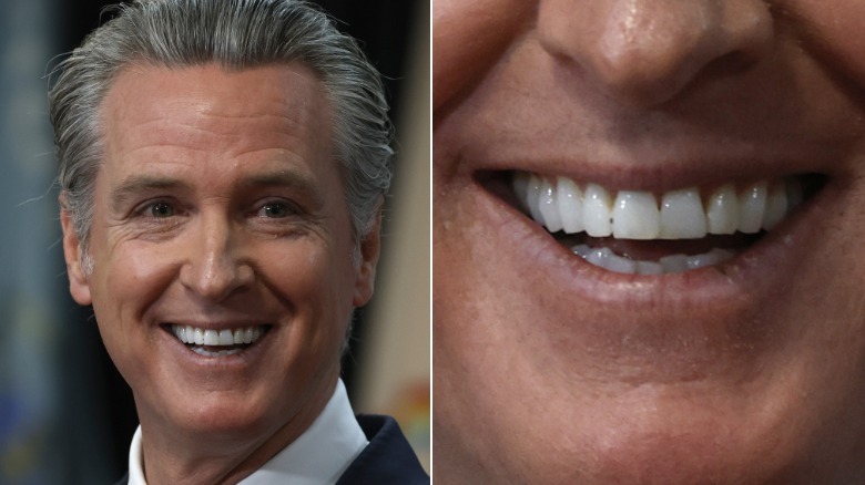 split screen of Gavin Newsom smiling and close-up of Newsom's teeth